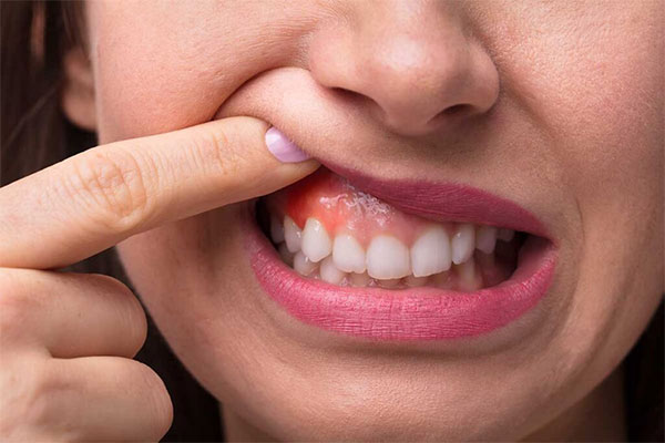 تشخیص سرطان دهان در سعادت آباد