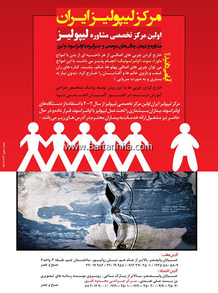 مرکز لیپولیز ایران