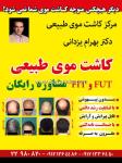 کلینیک کاشت موی طبیعی دکتر بهرام یزدانی