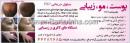 لیزر موهای زائد - صادقیه